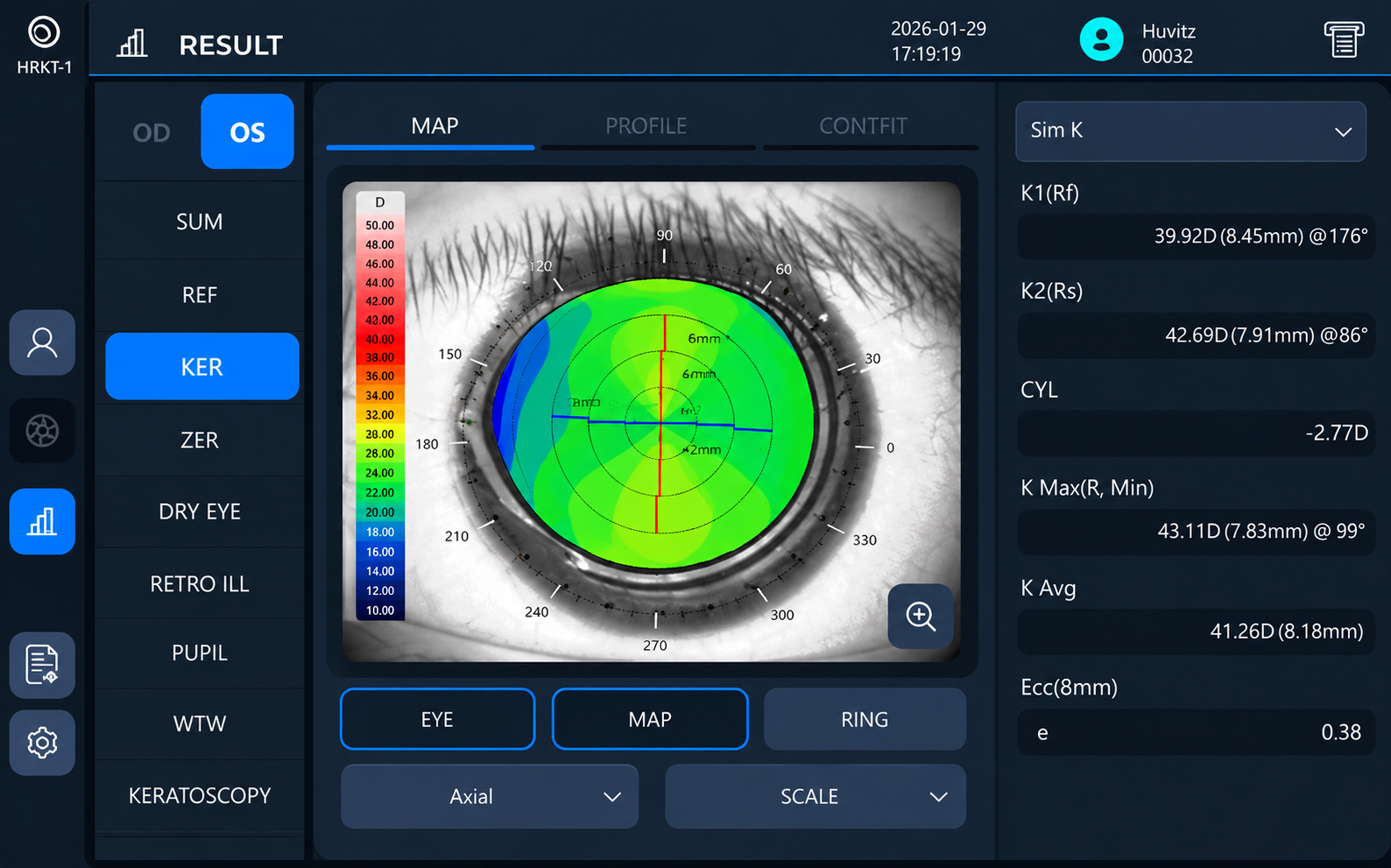 Huvitz HRKT-1 | Autorefractómetro, queratómetro, topógrafo y análisis de ojo seco - Imagen 4